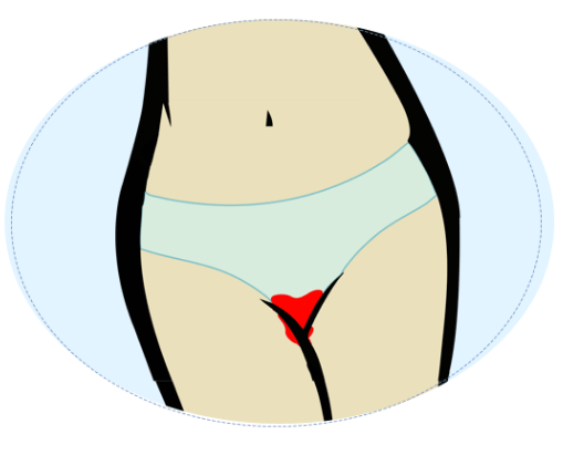 Image Title My Image